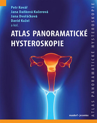Kovář, Petr; Daňková Kučerová, Jana; Dvořáčková, Jana - Atlas panoramatické hysteroskopie