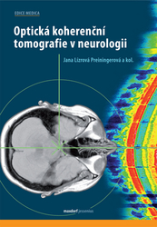 Lízrová Preiningerová, Jana - Optická koherenční tomografie v neurologii