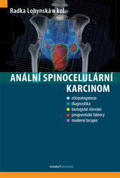 Lohynská, Radka - Anální spinocelulární karcinom