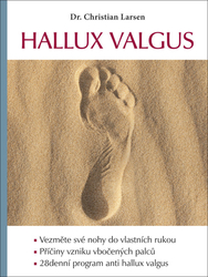 Larsen, Christian - Hallux valgus