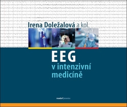 Doležalová, Irena - EEG v intenzivní medicíně