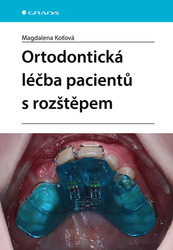Koťová, Magdalena - Ortodontická léčba pacientů s rozštěpem