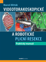 Mitták, Marcel - Videotorakoskopické a robotické plicní resekce