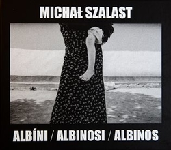 Szalast, Michal - Albíni, Albinosi, Albinos