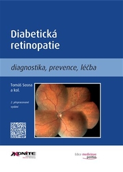 Sosna, Tomáš - Diabetická retinopatie